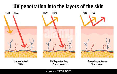 UV-Penetration in die Hautschichten. Infografik zum Sonnenschutzmittel gegen UVA-, UVB-Strahlen. Hautanatomie. Breitband-Sonnencreme. handdr Stock Vektor