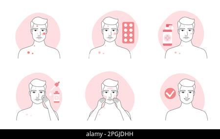 Akne-Behandlung für Mann Infografik Liniensatz Vektordarstellung. Handgezeichnete Umrisse, Jungs behandeln Pickel Ausschlag mit Pillen, Pubertät Gesichtsproblem, Hautpflegeprodukte auftragen, Salbe auf die Haut Stock Vektor