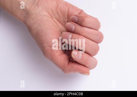 Nahaufnahme von weiblichen altersbezogenen Händen mit natürlich gebrochenen ungesunden, erkrankten Nägeln, überwucherter Kutikula auf weißem Hintergrund, Draufsicht, Kopierraum. Die Hand Stockfoto