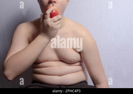 Ein übergewichtiger, weißer Teenager, der Apfel isst Stockfoto