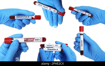 Collage mit Fotos von Wissenschaftlern, die Reagenzgläser mit Blutproben auf weißem Hintergrund halten, Nahaufnahme Stockfoto
