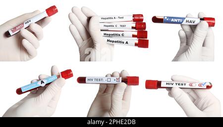 Collage mit Fotos von Wissenschaftlern, die Reagenzgläser mit Blutproben auf weißem Hintergrund halten, Nahaufnahme Stockfoto