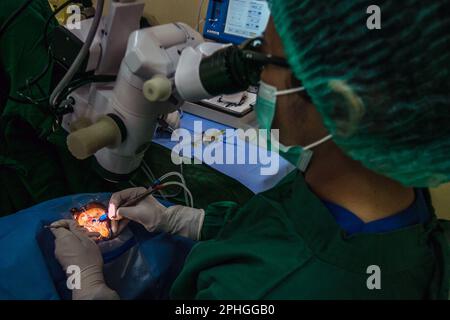 BOGOR, INDONESIEN - 27. März 2023: Ärzte führen Katarakt-Augenoperationen an Patienten mit Phakoemulsifizierungstechnik in Bogor, Indonesien, durch Stockfoto