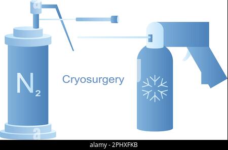 Kryogeräte für kryochirurgische Vektorliniendarstellung. Flüssigstickstoffkühlung für die kryogene Behandlung. Eistherapie bei benignen und malignen Läsionen. Stock Vektor