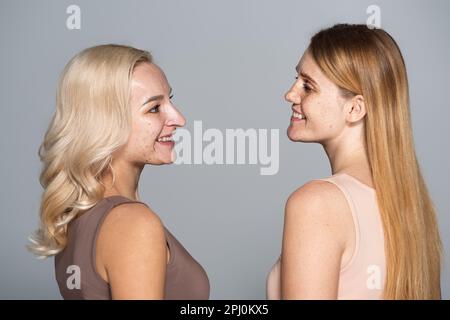 Seitenansicht von lächelnden Freunden mit Hautproblemen, die sich isoliert auf einem grauen Stockbild ansehen Stockfoto