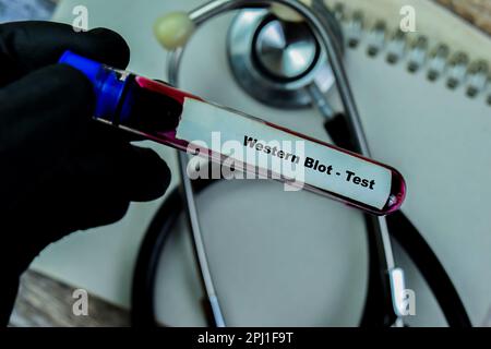 Konzept des Western Blot - Test mit Blutprobe. Gesundheitsfürsorge oder medizinisches Konzept Stockfoto