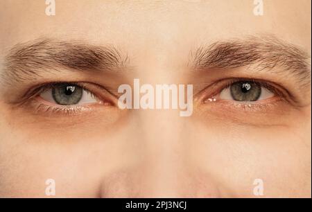 Müder Mann mit dunklen Kreisen unter den Augen, Nahaufnahme Stockfoto