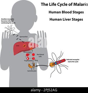 Lebenszyklus von Malariaparasiten, menschlichen Blutstadien und menschlichen Leberstadien Stock Vektor