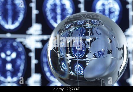 Gehirnforschung, Konzeptbild Stockfoto