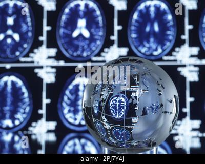 Gehirnforschung, Konzeptbild Stockfoto