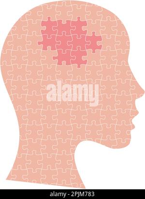 Weiblicher Kopf mit Puzzle und Puzzle. Hirnkrebs, onkologisches Medizinkonzept. Krebs mit Tumor und Zellen als Puzzleteile. Vektordarstellung Stock Vektor