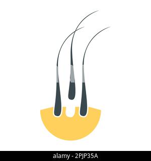Haartransplantat-Jocn für das Alopezie-Behandlungszentrum Stock Vektor