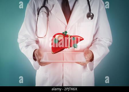 Arzt mit Tablette und Darstellung einer ungesunden Leber auf farbigem Hintergrund. Virushepatitis Stockfoto