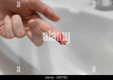 Nahaufnahme des blutigen Fingers einer Frau über der Spüle Stockfoto