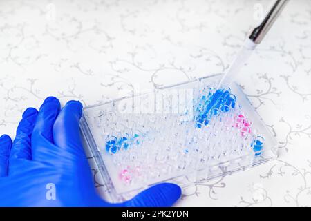 Wissenschaftler Arzt Pipettieren Proben im Labor mit vielen wissenschaftlichen Dingen - Becher, Zylinder, Pipette, Flüssigkeiten, Fläschchen, Ampulle, Ständer und mehr Stockfoto