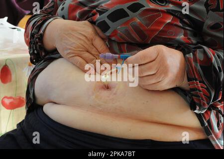 Selbstständige Landkrankenschwester im Haus eines Patienten mit Magenkrebs. Stockfoto