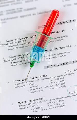 Probenkörper mit gefülltem Blutröhrchen, auf den Analyseergebnissen platziert. Stockfoto