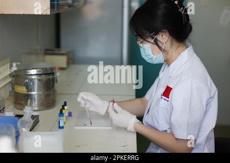 Dakar. 31. März 2023. Das chinesische medizinische Team-Mitglied Peng Jie identifiziert die Blutproben des Patienten am 21. März 2023 im Kinderkrankenhaus von Diamniadio in Dakar, Senegal. Das 19. Chinesische Ärzteteam, das nach Senegal entsandt wurde, bietet seit November 2021 medizinische Dienstleistungen im Kinderkrankenhaus von Diamniadio an. Bis zum 31. März 2023 hatte das medizinische Team 7.058 ambulante Leistungen erbracht, 3.150 Operationen und 1.039 Narkosefälle abgeschlossen. Kredit: Wang Zizheng/Xinhua/Alamy Live News Stockfoto