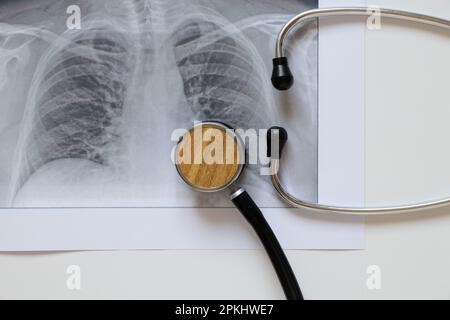 Fluorographische Darstellung der Lungen auf Papier und ein Stethoskop, gesunde Lungen eines Mannes für eine Routineuntersuchung Stockfoto