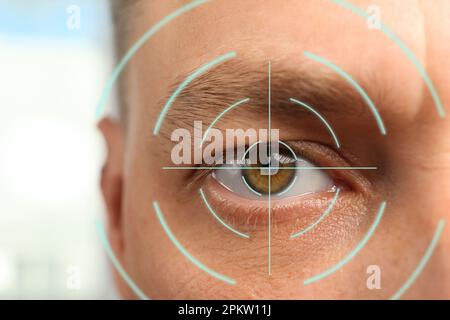 Nahaufnahme des Menschen und Markierung der Illustration auf seinem Auge. Sehkorrekturoperationen Stockfoto