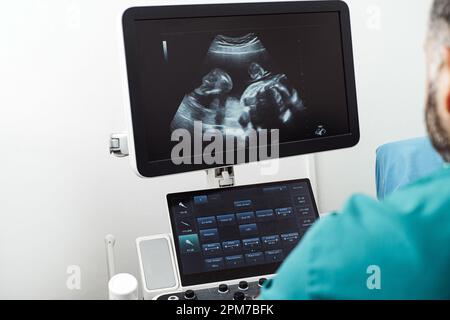 Ein Mediziner, der auf den Ultraschallbildschirm schaut. Schwangerschaftskonzept. Stockfoto