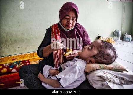 Hydrozephalus-Kinder, Semarang, Java, Indonesien, Asien Stockfoto