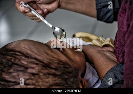 Hydrozephalus-Kinder, Semarang, Java, Indonesien, Asien Stockfoto