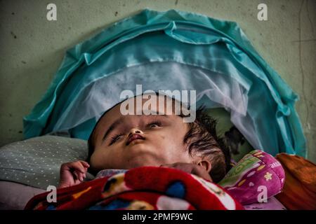 Hydrozephalus-Kinder, Semarang, Java, Indonesien, Asien Stockfoto