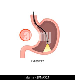 Endoskopie-Logo-Symbol. Magengastroskopie Cartoon Gastritis Medizin signalisieren Krebs egd System Icon. Stock Vektor