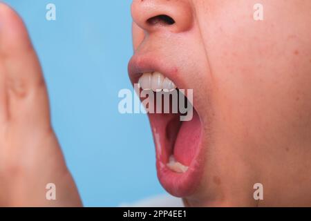 Eine Frau, die ihren Mund bedeckt, um den Mundgeruch zu riechen. Junge Dame, die mit den Händen den Atem kontrolliert. Mundgesundheitsprobleme oder zahnärztliches Pflegekonzept. Stockfoto