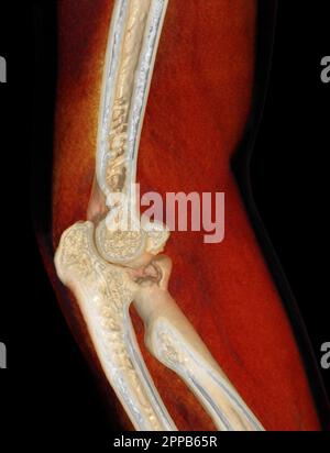 CT-Darstellung der 3D-Darstellung des Ellenbogengelenkes. Stockfoto