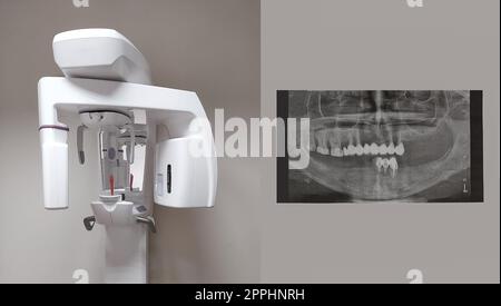 Moderner zahnärztlicher digitaler 3D-Tomographen Stockfoto