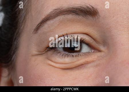 Nahaufnahme einer Frau mit braunem Auge. Makro von Augenbeuteln und dunklen Kreisen. Begriff der Zeichen des Alterns wie Falten und Stresssymptome Stockfoto