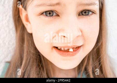 Ein bezauberndes, lächelndes kleines Mädchen mit offenem Mund zeigt, wie es sich abspielt, wenn es aus dem ersten Milchzahn fällt. Vorschulzähne wechseln sich. Gesund Stockfoto