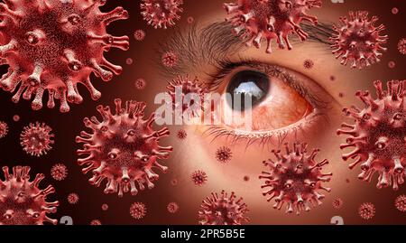 Virale Konjunktivitis hochinfektiöse Augeninfektion oder infizierte rosa Augen als Virusinfektionen oder allergische Reaktion und Allergien als Augenheilkunde Stockfoto