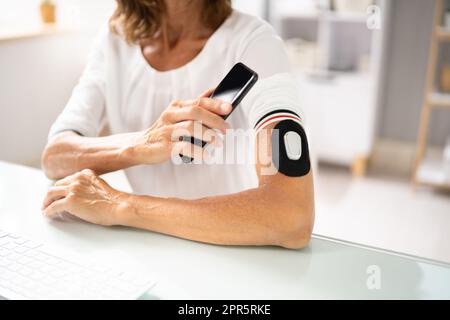 Kontinuierliche Blutzuckerkontrolle Mit Smartphone. Patient Stockfoto