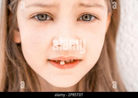 Ein bezauberndes, lächelndes kleines Mädchen mit offenem Mund zeigt, wie es sich abspielt, wenn es aus dem ersten Milchzahn fällt. Vorschulzähne wechseln sich. Gesund Stockfoto