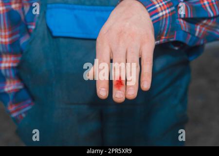 Schnitt zu Blut, Finger Schmerzen, Wundblut, Hand Nahaufnahme. Stockfoto