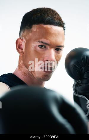 Wenn das Leben hart wird, ziehen Sie Ihre Boxhandschuhe an. Zugeschnittenes Porträt eines hübschen jungen Boxers mit Vitiligo, der im Studio posiert. Stockfoto