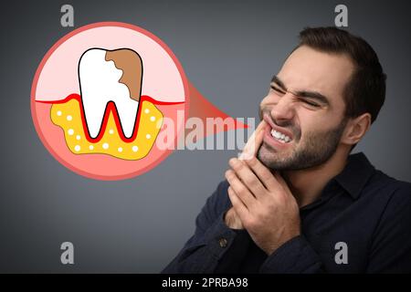 Junge Menschen leiden unter Zahnschmerzen auf grauem Hintergrund Stockfoto