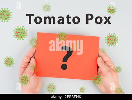 Tomatenpocken, Ausbruch des Virus in Indien, Infektionskrankheit breitet sich aus Stockfoto