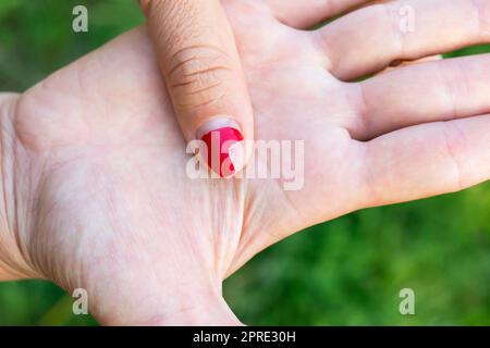 Das Mädchen zeigt eine schlechte alte Maniküre. Überwucherter Nagellack, gebrochener Nagel. Maniküre Korrektur, alte Maniküre. Nagelpflege, es ist Zeit, in den Salon zu gehen Stockfoto