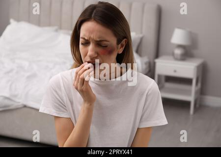 Frau mit Gesichtsverletzungen im Schlafzimmer. Opfer häuslicher Gewalt Stockfoto