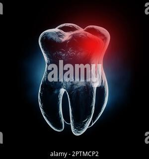Medizinisch akkurate Röntgenaufnahme des Zahnschmerzes mit roter Schmerzzone auf schwarzem Hintergrund. 3D-Rendering Stockfoto