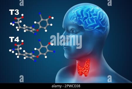 Darstellung eines Menschen mit entzündeter Schilddrüse auf farbigem Hintergrund Stockfoto