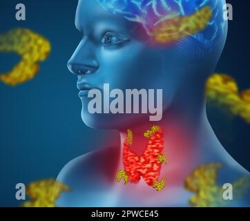 Darstellung eines Menschen mit entzündeter Schilddrüse auf farbigem Hintergrund Stockfoto