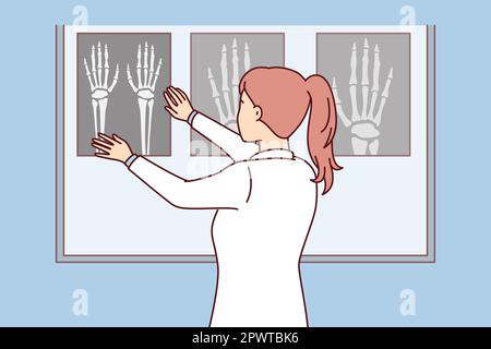 Chirurg-Frau wendet Handröntgen auf das leuchtende Brett an, um Stellen von Knochenbrüchen beim Patienten zu sehen. Die Krankenschwester steht mit dem Rücken zum Bildschirm und sieht sich das Bild an Stockfoto