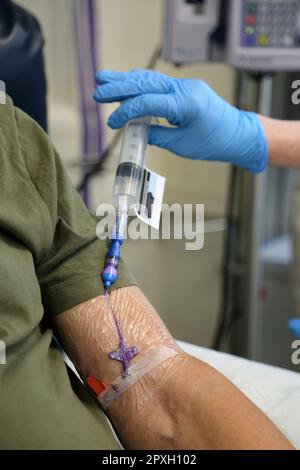 Chemotherapie-Medikament Fluorouracil wird in Picc Line des männlichen Krebspatienten im Krankenhaus Surrey England injiziert Stockfoto