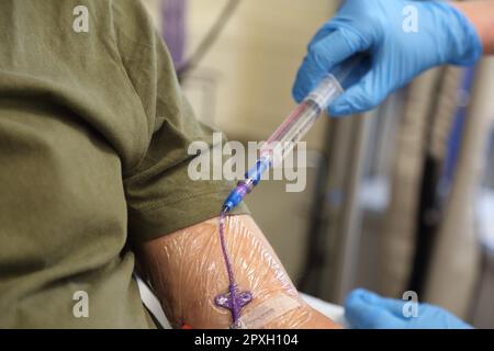 Lösung Kochsalzlösung Spülung zur Spülung der ZVK (peripher eingeführter zentraler Katheter) Stockfoto