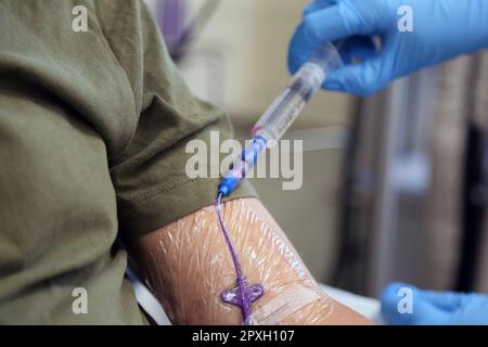 Lösung Kochsalzlösung Spülung zur Spülung der ZVK (peripher eingeführter zentraler Katheter) Stockfoto